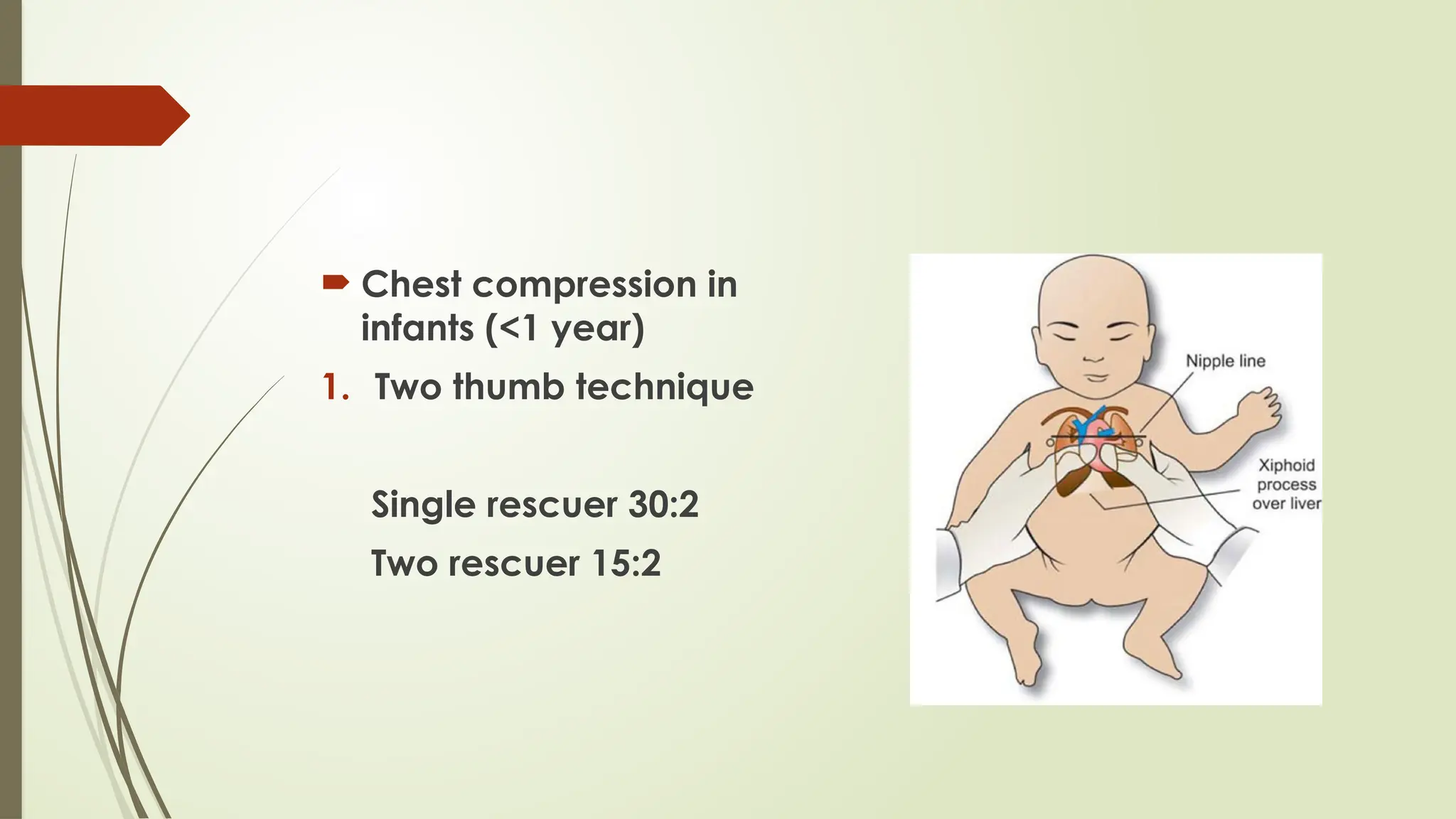  Chest compression in
infants (<1 year)
1. Two thumb technique
Single rescuer 30:2
Two rescuer 15:2
 