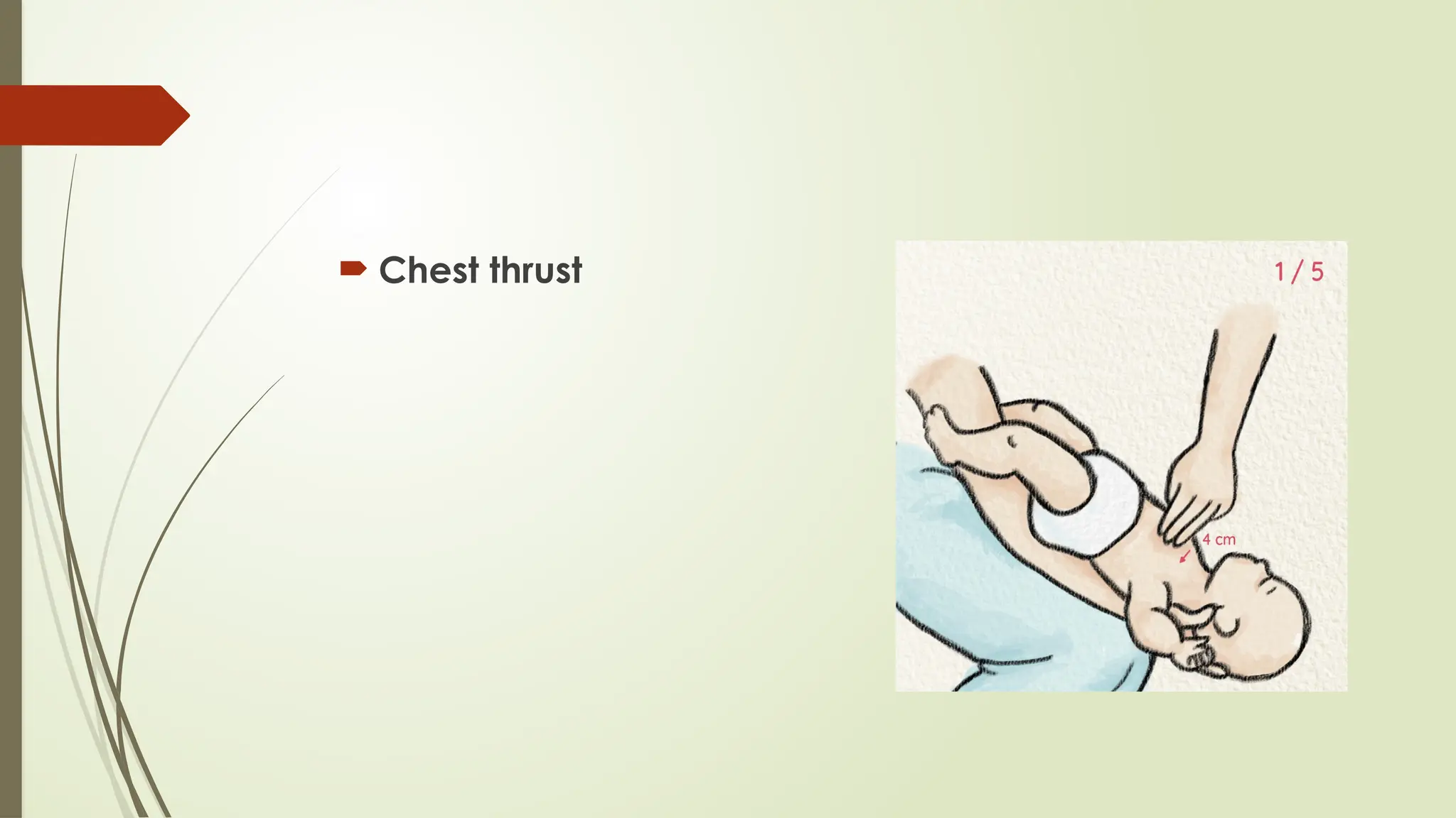  Chest thrust
 