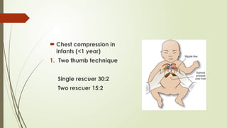  Chest compression in
infants (<1 year)
1. Two thumb technique
Single rescuer 30:2
Two rescuer 15:2
 