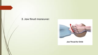 2. Jaw thrust maneuver:
 