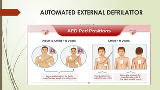 AUTOMATED EXTERNAL DEFRILATTOR
(AED)
 