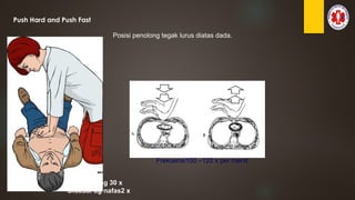 Push Hard and Push Fast
Pijat jantung 30 x
Disusul dg nafas2 x
Posisi penolong tegak lurus diatas dada.
Frekuensi100 –120 x per menit
 