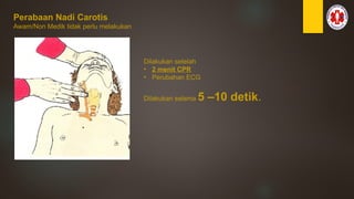 Perabaan Nadi Carotis
Awam/Non Medik tidak perlu melakukan
Dilakukan setelah
• 2 menit CPR
• Perubahan ECG
Dilakukan selama 5 –10 detik.
 