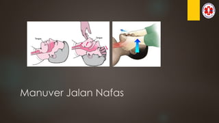 Manuver Jalan Nafas
 