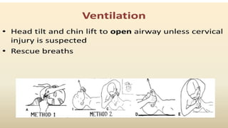 Comprehensive Basic Life Support (BLS) Training: CPR, AED, and Airway ...