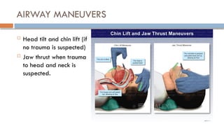 AIRWAY MANEUVERS
 Head tilt and chin lift (if
no trauma is suspected)
 Jaw thrust when trauma
to head and neck is
suspected.
 