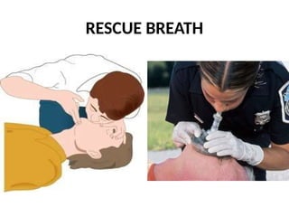 RESCUE BREATH
 