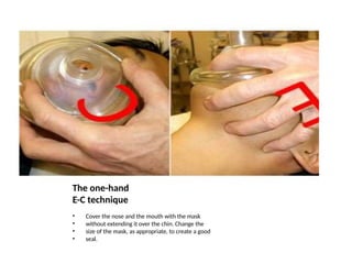 The one-hand
E-C technique
• Cover the nose and the mouth with the mask
• without extending it over the chin. Change the
• size of the mask, as appropriate, to create a good
• seal.
 