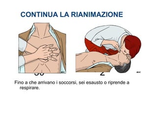 CONTINUA LA RIANIMAZIONE
30 2
Fino a che arrivano i soccorsi, sei esausto o riprende a
respirare.
 