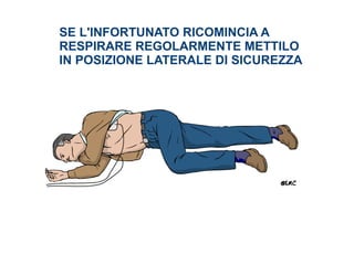 SE L'INFORTUNATO RICOMINCIA A
RESPIRARE REGOLARMENTE METTILO
IN POSIZIONE LATERALE DI SICUREZZA
 