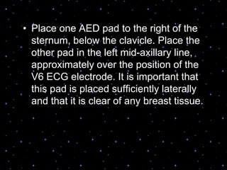 Placement of AED pads• Place one AED pad to the right of the
sternum, below the clavicle. Place the
other pad in the left mid-axillary line,
approximately over the position of the
V6 ECG electrode. It is important that
this pad is placed sufficiently laterally
and that it is clear of any breast tissue.
 