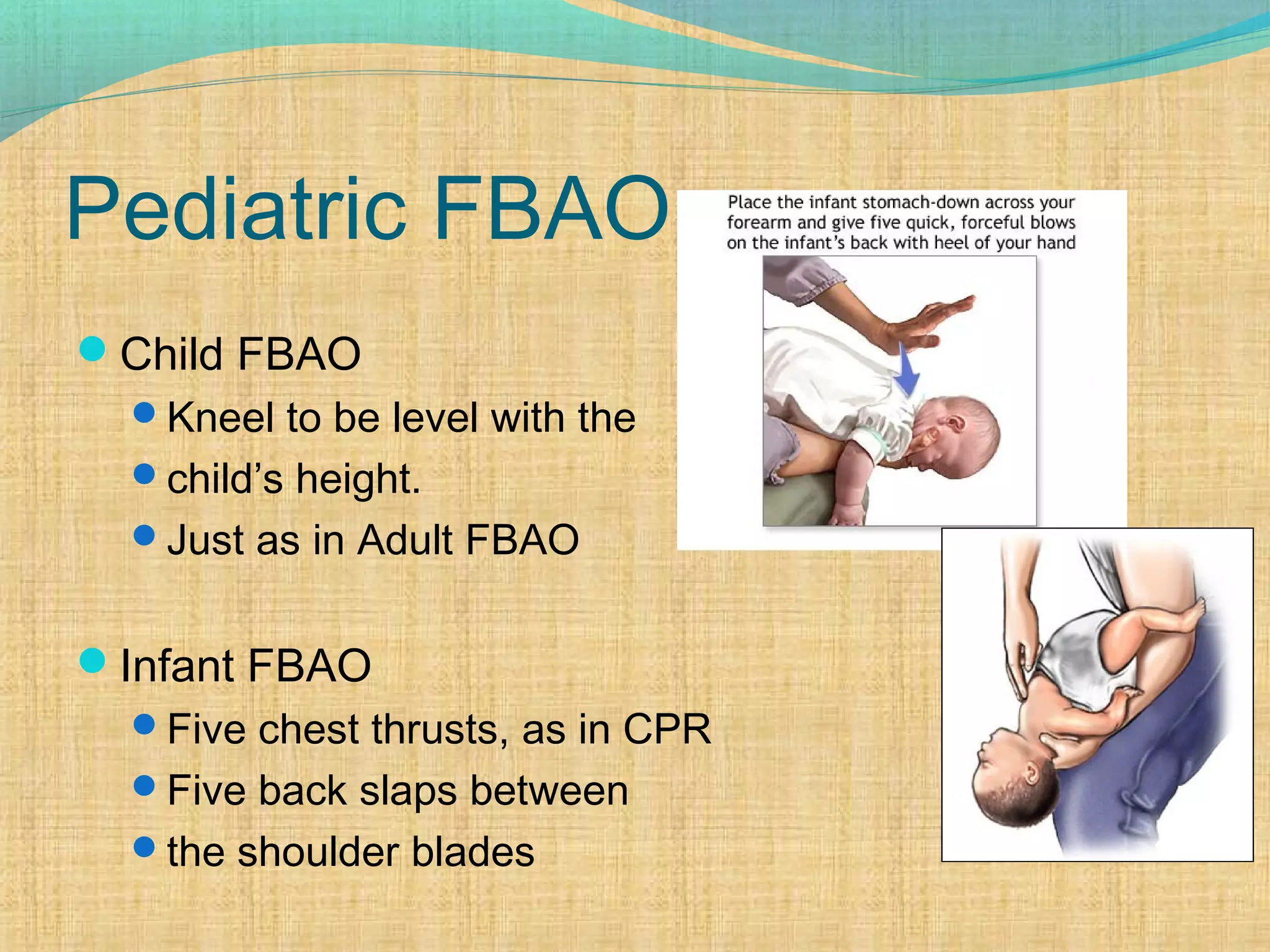 Pediatric FBAO
Child FBAO
Kneel to be level with the
child’s height.
Just as in Adult FBAO
Infant FBAO
Five chest thrusts, as in CPR
Five back slaps between
the shoulder blades
 