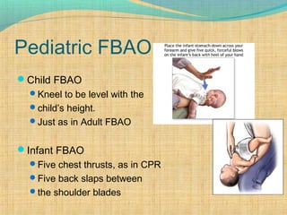 Pediatric FBAO
Child FBAO
Kneel to be level with the
child’s height.
Just as in Adult FBAO
Infant FBAO
Five chest thrusts, as in CPR
Five back slaps between
the shoulder blades
 