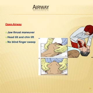 AIRWAY
25
Open Airway
 Jaw thrust maneuver
 Head tilt and chin lift
 No blind finger sweep
 