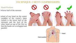 TECHNIQUE: CHEST COMPRESSIONS
Hand Position:
lower half of the sternum
heel of one hand on the center
(middle) of the victim’s chest
(which is the lower half of the
sternum) and the heel of the
other hand on top of the first so
that the hands are overlapped and
parallel.
 