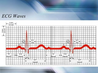 ECG Waves
 