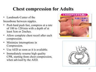 Basic life Support CPR.pptgghhhhhgggggggg | PPT