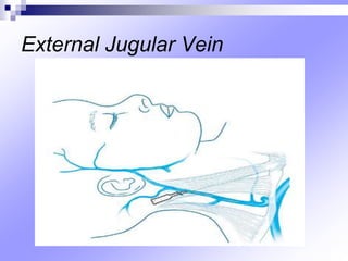 External Jugular Vein
 