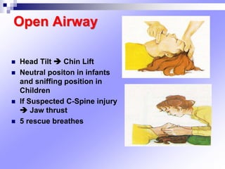 Open Airway
 Head Tilt  Chin Lift
 Neutral positon in infants
and sniffing position in
Children
 If Suspected C-Spine injury
 Jaw thrust
 5 rescue breathes
 