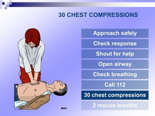 30 CHEST COMPRESSIONS
Approach safely
Check response
Shout for help
Open airway
Check breathing
Call 112
30 chest compressions
2 rescue breaths
 