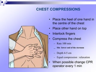 • Place the heel of one hand in
the centre of the chest
• Place other hand on top
• Interlock fingers
• Compress the chest
– Rate 100 min
– Site lower end of the sternum
– Depth 4-5 cm
– Equal compression : relaxation
• When possible change CPR
operator every 1 min
CHEST COMPRESSIONS
 