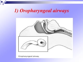 1) Oropharyngeal airways
 