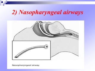 2) Nasopharyngeal airways
 