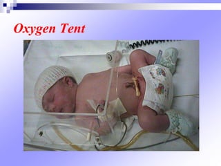 Oxygen Tent
 
