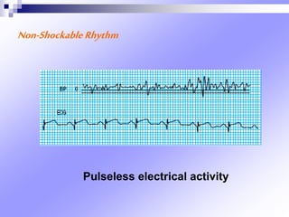 Non-ShockableRhythm
Pulseless electrical activity
 