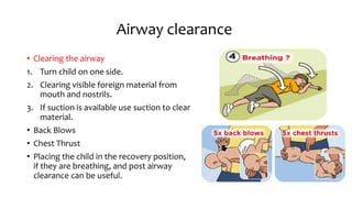 Airway clearance
• Clearing the airway
1. Turn child on one side.
2. Clearing visible foreign material from
mouth and nostrils.
3. If suction is available use suction to clear
material.
• Back Blows
• Chest Thrust
• Placing the child in the recovery position,
if they are breathing, and post airway
clearance can be useful.
 