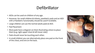 Defibrillator
• AEDs can be used on children of any age.
• However, for small children & infants, paediatric pads and an AED
with a Paediatric functionality should be used if available.
• Large children can use the normal adults pads & AED.
• Pad Placement
• Most pads have a diagram on them illustrating where to place
them (e.g. right upper chest & left lower side).
• Pads should never be touching each other.
• In small children you can alternatively place one pad on the front
of the chest, and one on the back.
 