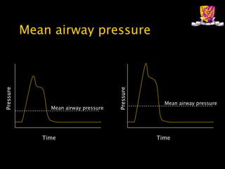 Mean airway pressure Time Pressure Time Pressure Mean airway pressure Mean airway pressure 