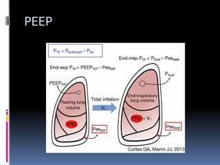 Peep Explained basic mechanical ventilation anesthesia.pptx