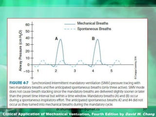 Clinical Application of Mechanical Ventilation, Fourth Edition by David W. Chang
dr.shumaylaaslam@gmail.co
m
37
 