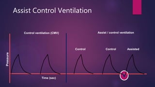 Time (sec)
Control ventilation (CMV) Assist / control ventilation
Pressure
Control Control Assisted
Assist Control Ventilation
 