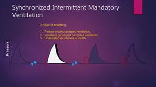 Synchronized Intermittent Mandatory
Ventilation
Pressure
3 types of breathing:
1. Patient initiated assisted ventilation,
2. Ventilator generated controlled ventilation,
3. Unassisted spontaneous breath.
 