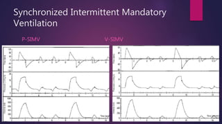 Synchronized Intermittent Mandatory
Ventilation
P-SIMV V-SIMV
 