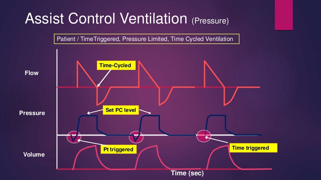 Basic modes of mechanical ventilation