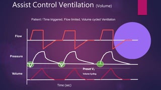 basicmodesofmechanicalventilation-160117181821 (1).pptx
