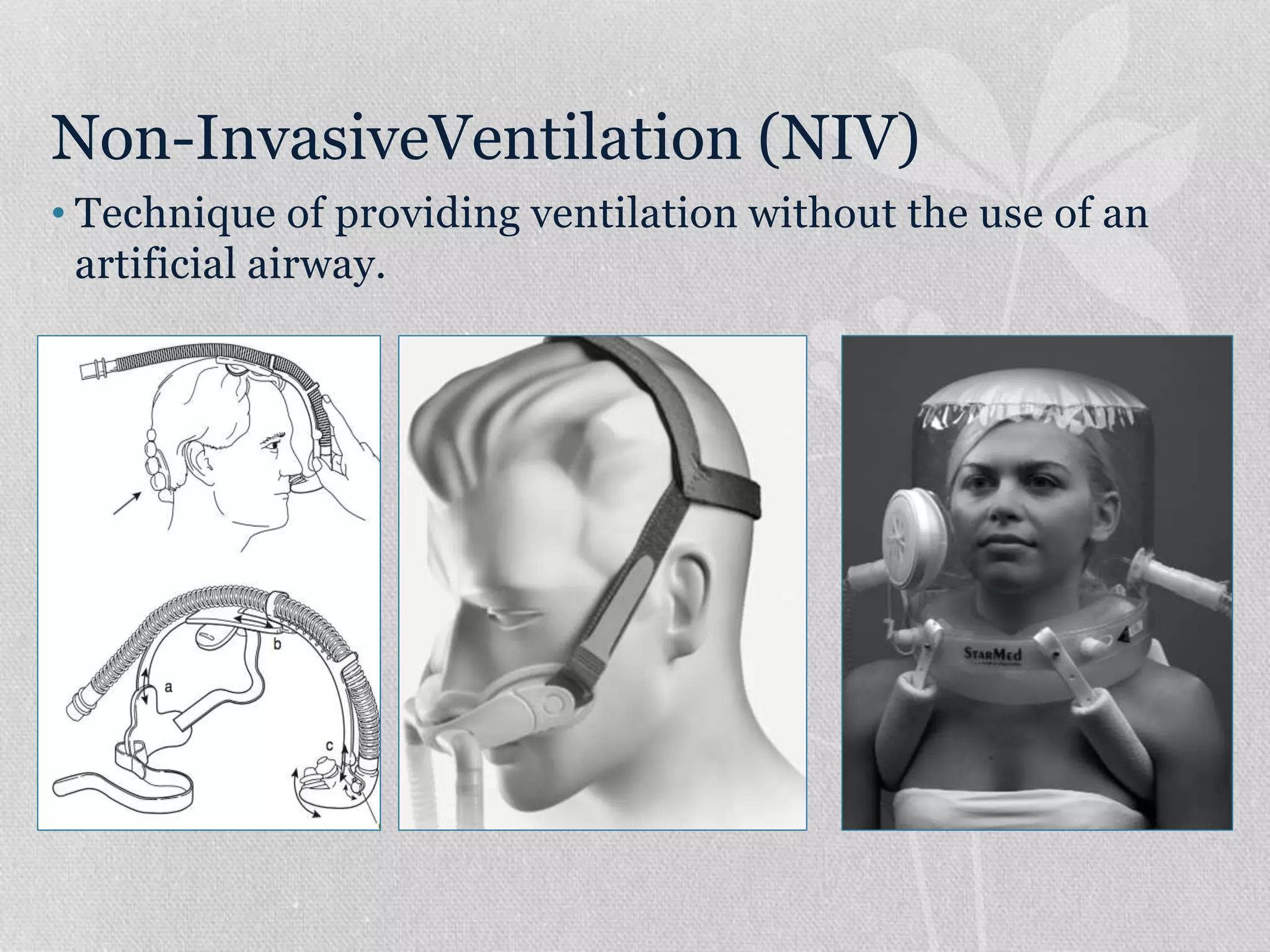 Non-InvasiveVentilation (NIV)
• Technique of providing ventilation without the use of an
artificial airway.
 