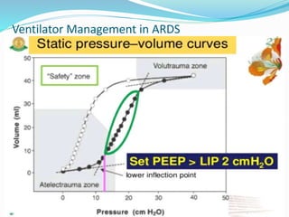 Ventilator Management in ARDS
 