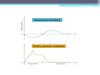 BASIC MODES OF MECHANICAL VENTILATION .pdf