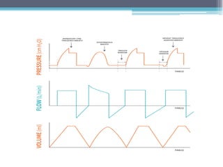 BASIC MODES OF MECHANICAL VENTILATION .pdf