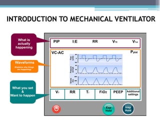 BASIC MODES OF MECHANICAL VENTILATION .pdf