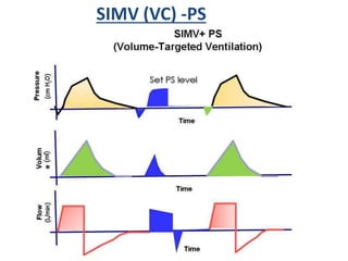 SIMV (VC) -PS
 