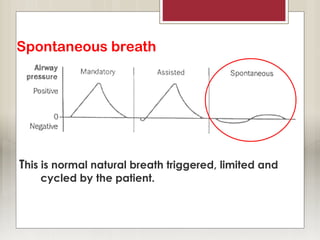 Spontaneous breath
This is normal natural breath triggered, limited and
cycled by the patient.
 