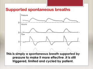 Supported spontaneous breaths
This is simply a spontaneous breath supported by
pressure to make it more effective .It is still
triggered, limited and cycled by patient.
 