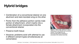 Fixed Prosthodontics: Bridge Types, Designs, and Longevity | PDF