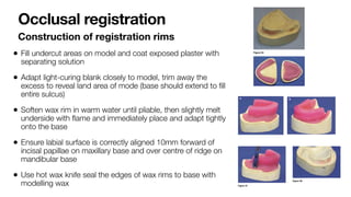 Partial Registration Rim Lab Procedures for Removable and Fixed Prosthesis in Dentistry | PDF