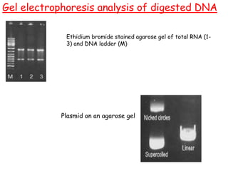 Gel electrophoresis analysis of digested DNA
Ethidium bromide stained agarose gel of total RNA (1-
3) and DNA ladder (M)
Plasmid on an agarose gel
 